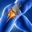 Hip replacement surgery hospital in hyderabad - arun ortho care