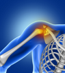 Shoulder replacement surgery hospital in hyderabad - arun ortho care